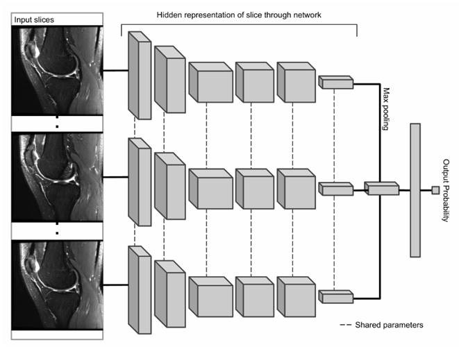 The MRNet architecture
